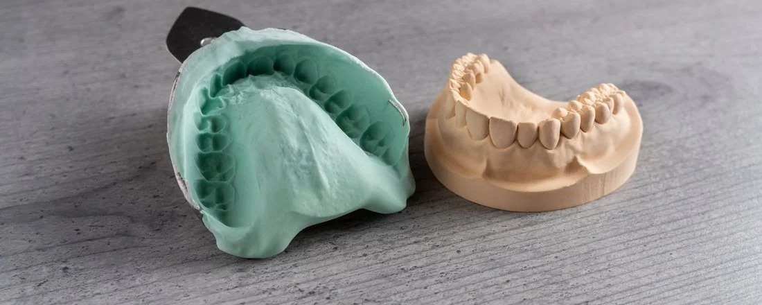 バリエーション豊かな素材と形で理想の入れ歯を作製します